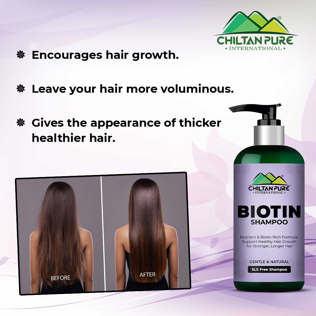 Biotin Shampoo – Hydrates Scalp, Promotes Healthy Hair Growth, Reduce Split Ends & Prevents Hair Breakage,, Doctor's 👨⚕️ Recommended - Mamasjan