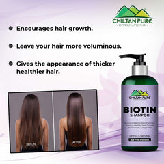 Biotin Shampoo – Hydrates Scalp, Promotes Healthy Hair Growth, Reduce Split Ends & Prevents Hair Breakage,, Doctor's 👨⚕️ Recommended - Mamasjan